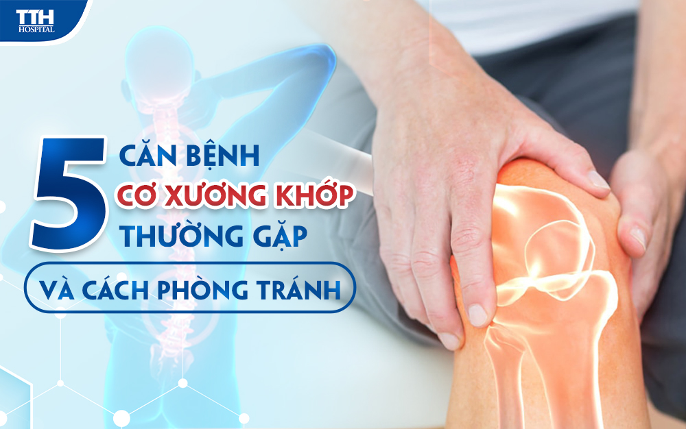5 Căn bệnh cơ xương khớp thường gặp và cách phòng tránh